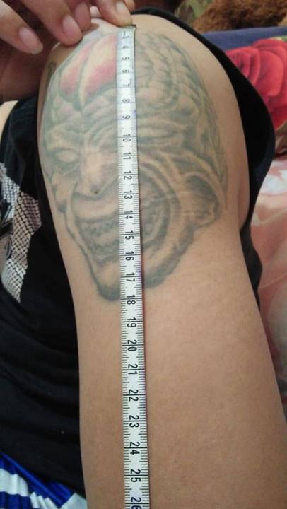 hapus tattoo bali